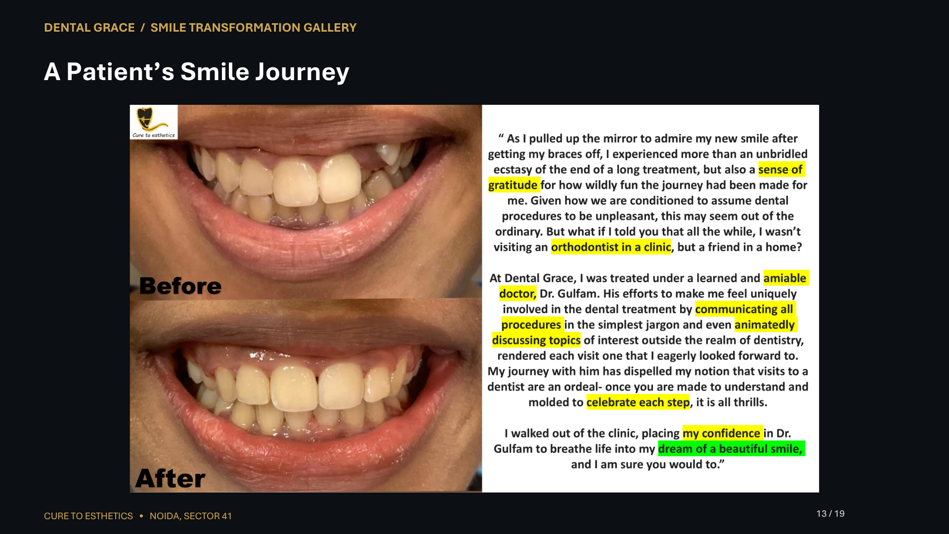 Dental Grace patient result 13 – before and after smile transformation