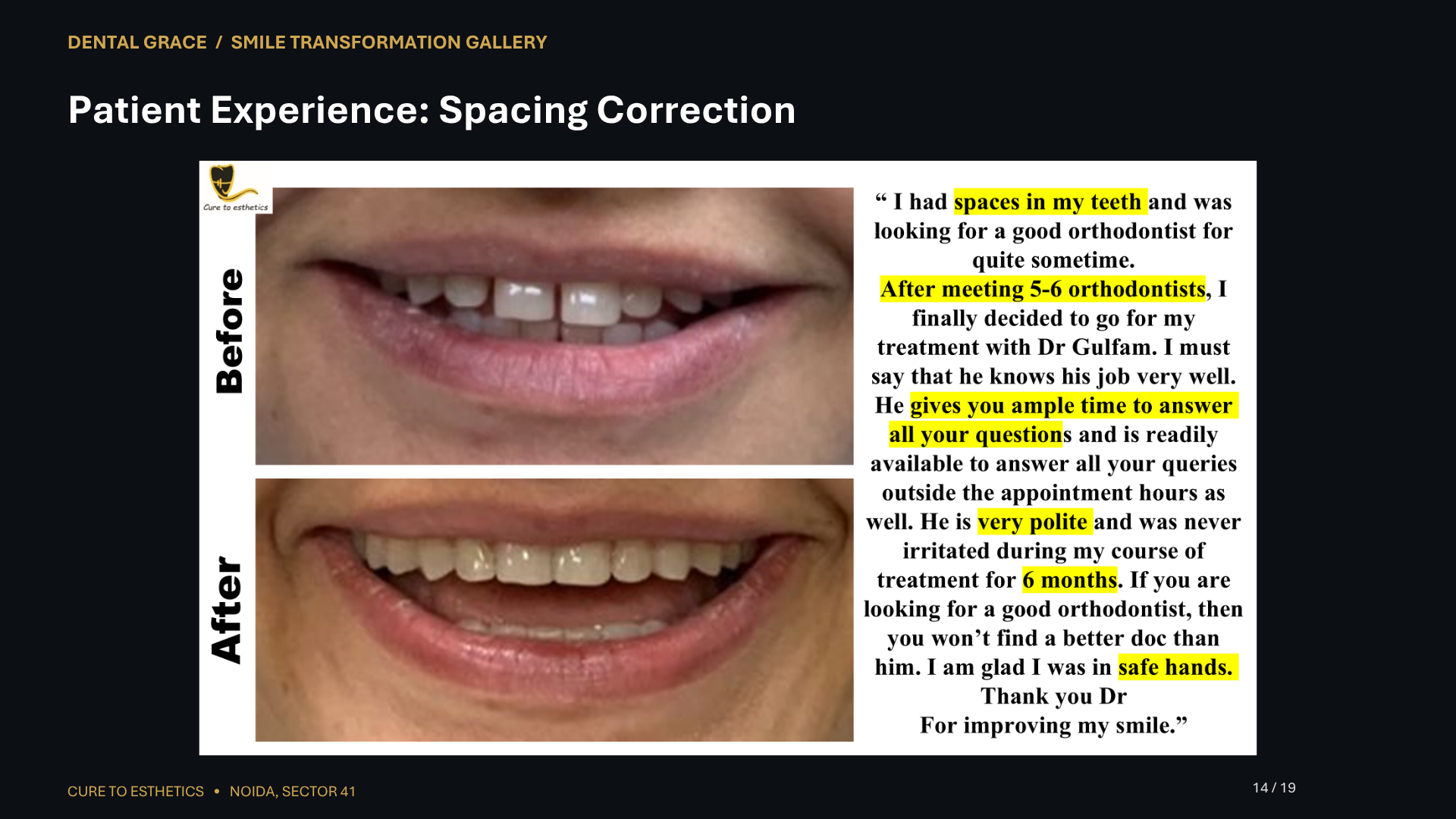 Dental Grace patient result 14 – before and after smile transformation