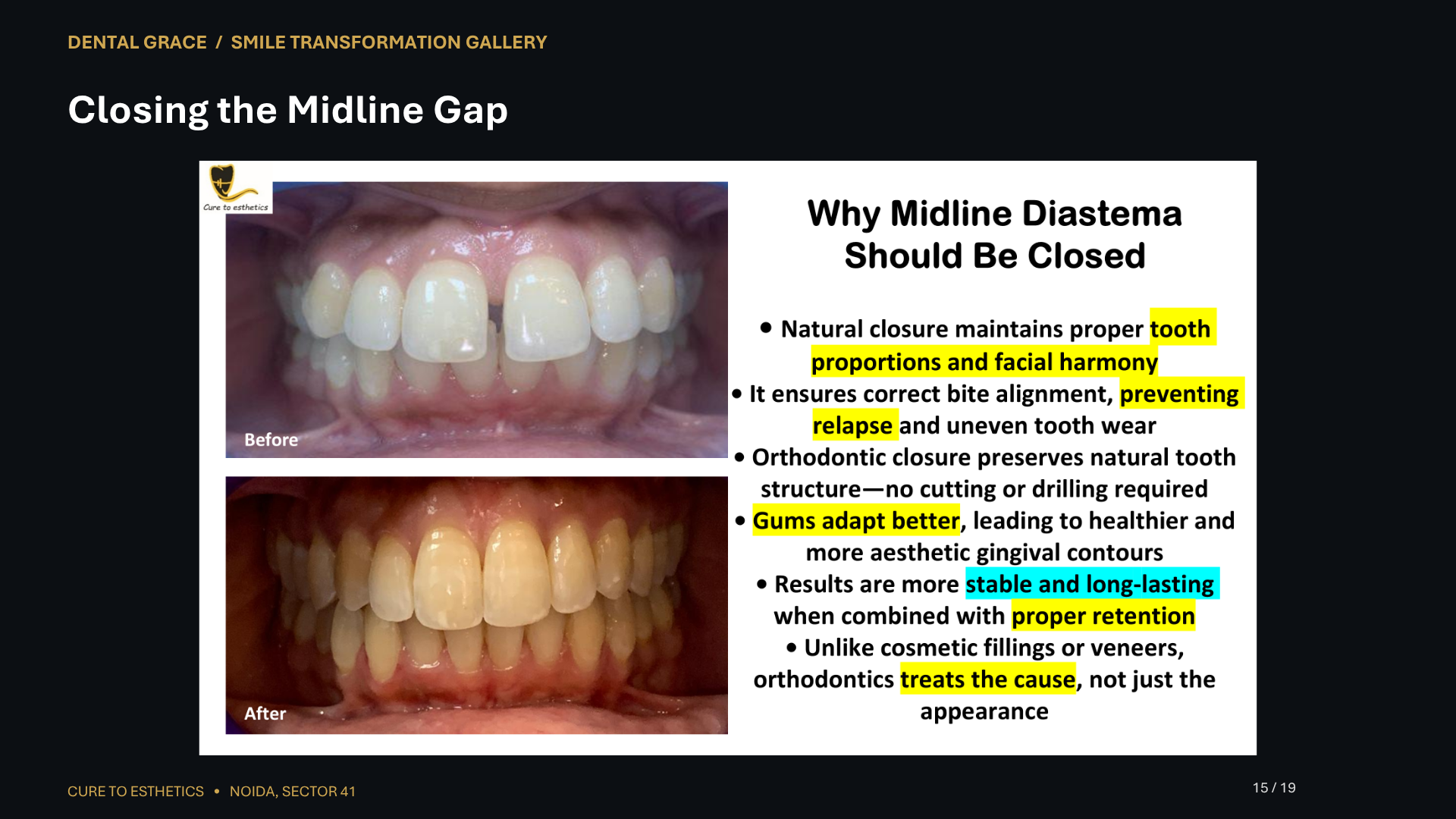 Dental Grace patient result 15 – before and after smile transformation