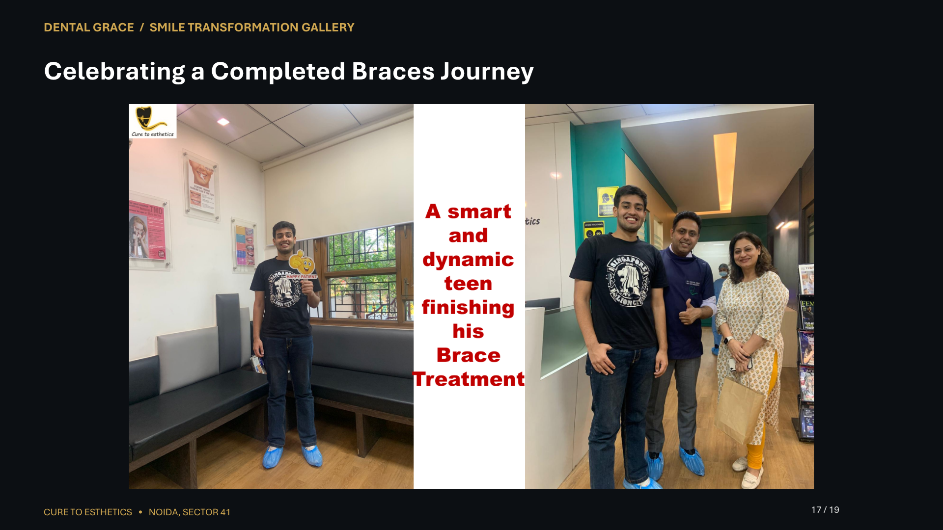 Dental Grace patient result 17 – before and after smile transformation