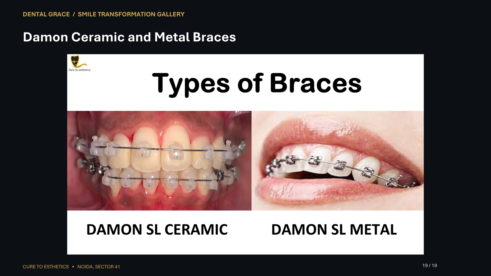 Dental Grace patient result 19 – before and after smile transformation